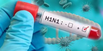 Namibia records 54 H1N1 cases